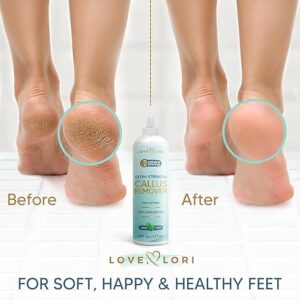 Callus Remover for Feet (Extra Strength) Foot Callus Remover