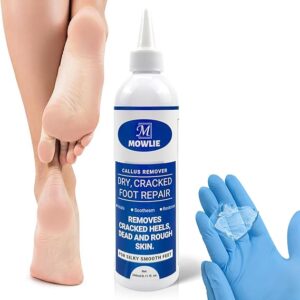 Extra Strength Foot Callus Remover Gel – Professional Callus Remover for Feet,Instantly Softens Dry & Cracked Skin